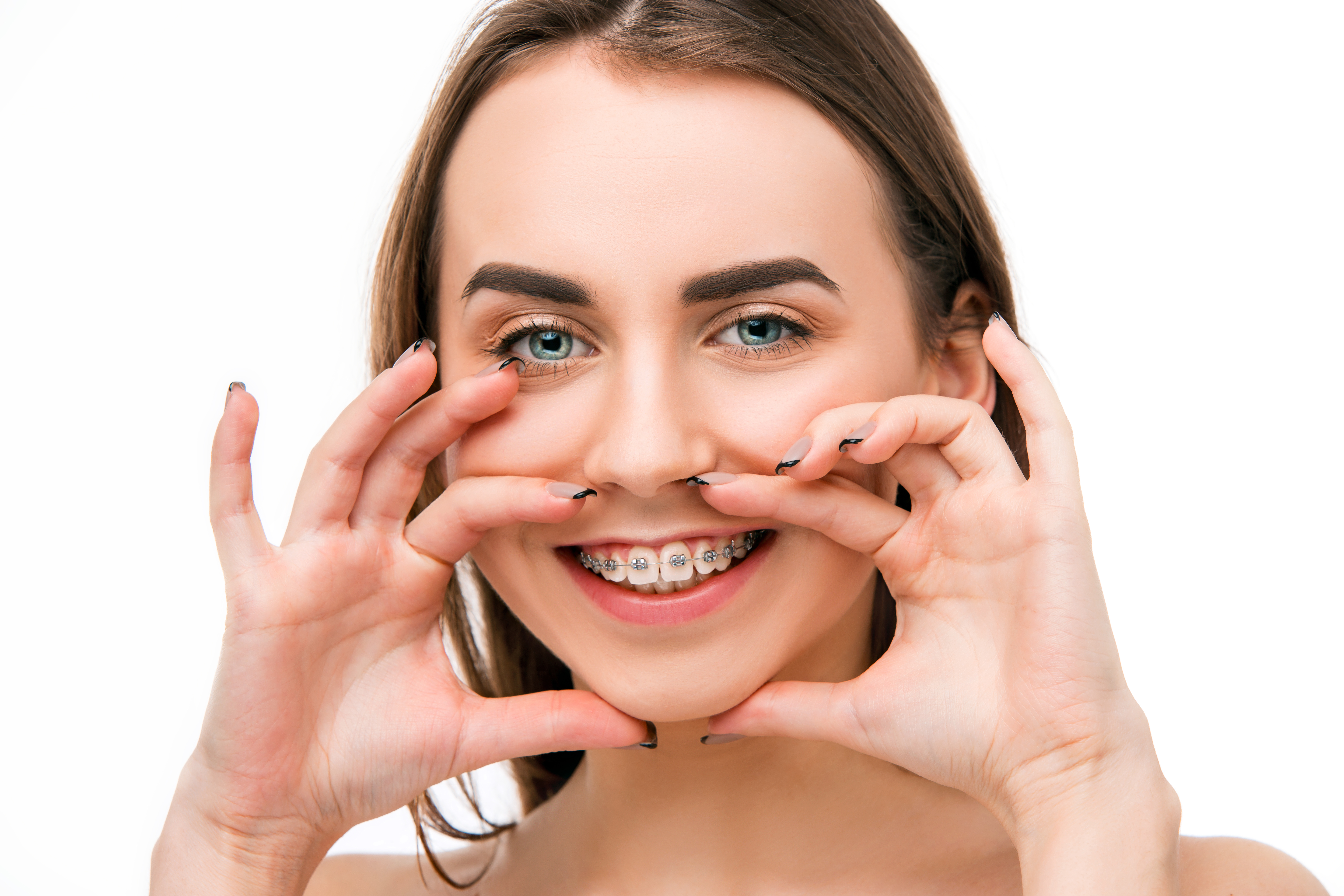 dental braces cost in bangalore 